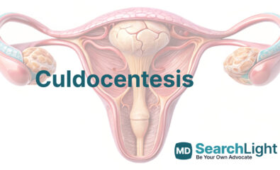 Culdocentesis