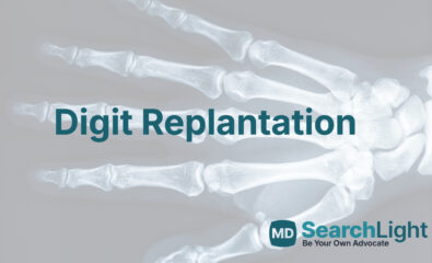 Digit Replantation