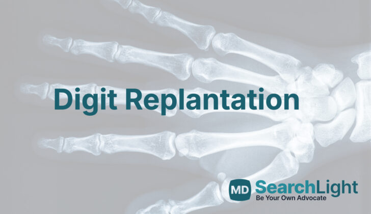 Digit Replantation