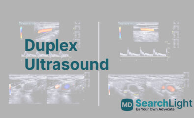 Duplex Ultrasound