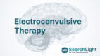Electroconvulsive Therapy
