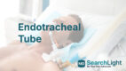 Endotracheal Tube