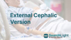 External Cephalic Version