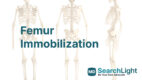 Femur Immobilization