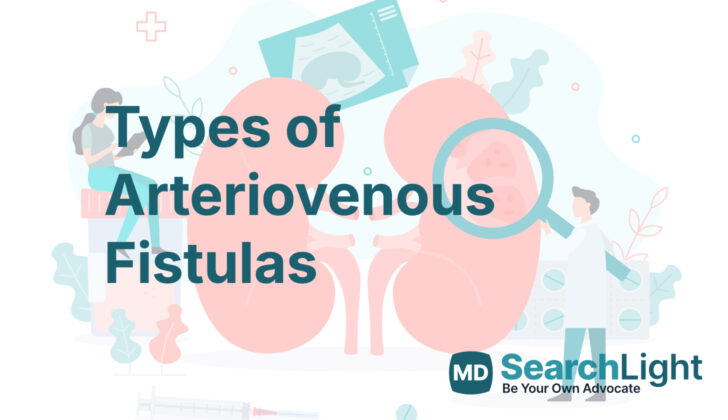 Types of Arteriovenous Fistulas