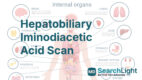 Hepatobiliary Iminodiacetic Acid Scan
