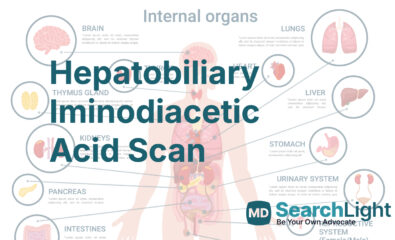 Hepatobiliary Iminodiacetic Acid Scan