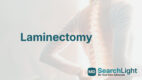 Laminectomy