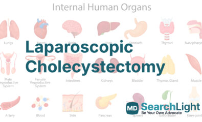 Laparoscopic Cholecystectomy