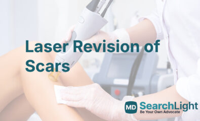 Laser Revision of Scars