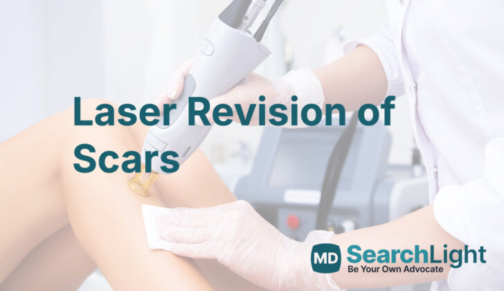 Laser Revision of Scars