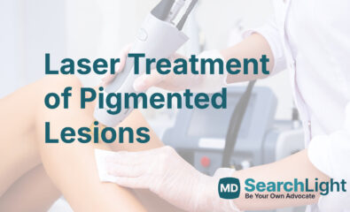 Laser Treatment of Pigmented Lesions