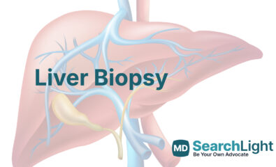 Liver Biopsy