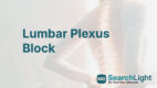 Lumbar Plexus Block