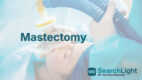 Mastectomy