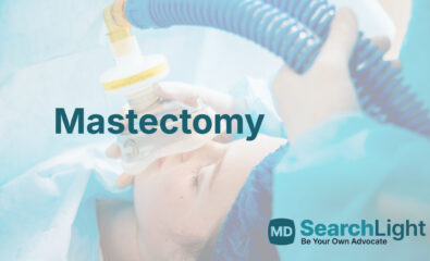 Mastectomy