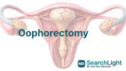 Oophorectomy