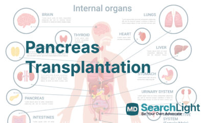 Pancreas Transplantation