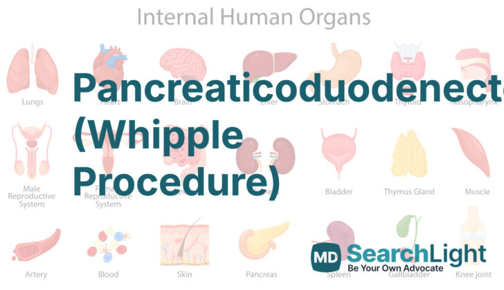 Pancreaticoduodenectomy (Whipple Procedure)