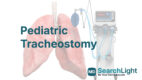 Pediatric Tracheostomy
