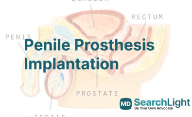 Penile Prosthesis Implantation