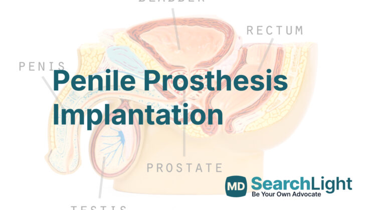 Penile Prosthesis Implantation