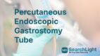 Percutaneous Endoscopic Gastrostomy Tube
