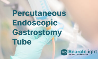 Percutaneous Endoscopic Gastrostomy Tube