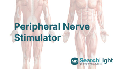 Peripheral Nerve Stimulator