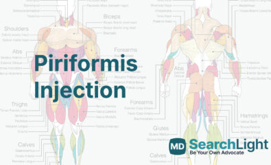 Piriformis Injection