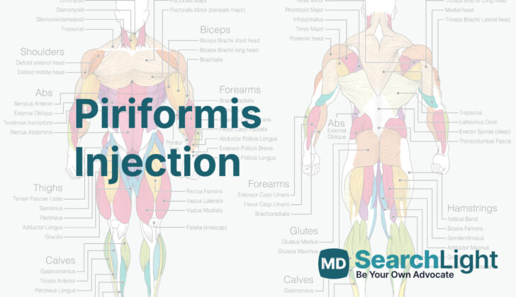 Piriformis Injection
