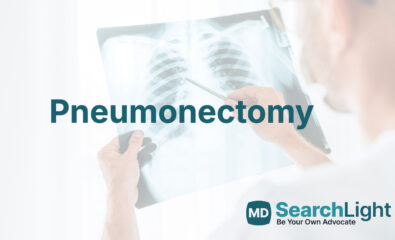 Pneumonectomy