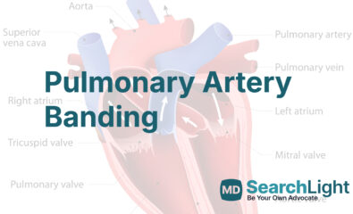 Pulmonary Artery Banding