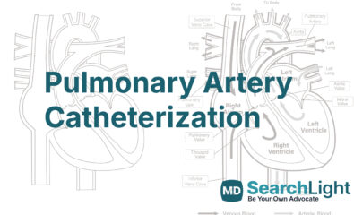 Pulmonary Artery Catheterization