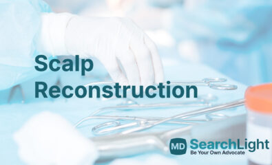 Scalp Reconstruction