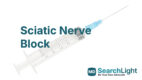 Sciatic Nerve Block