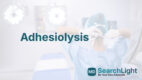 Adhesiolysis