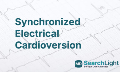 Synchronized Electrical Cardioversion