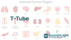 T-Tube