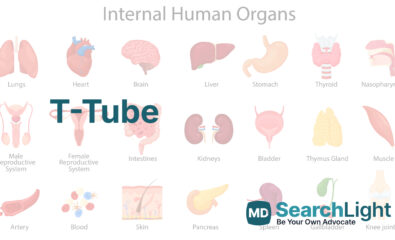 T-Tube