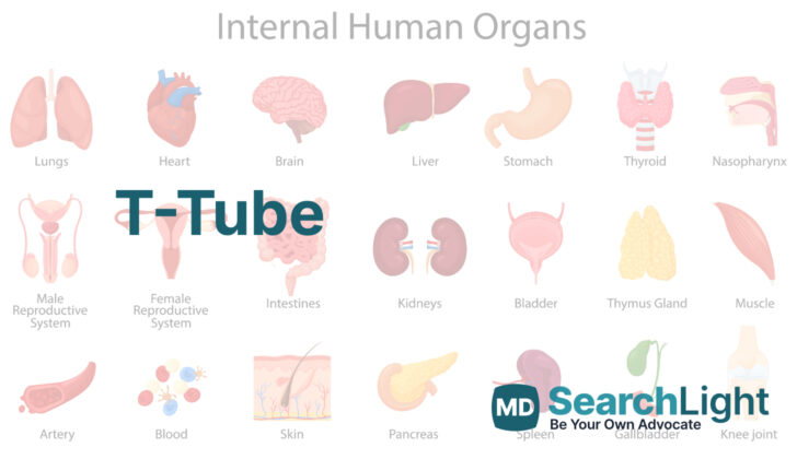 T-Tube
