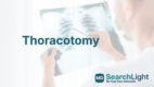 Thoracotomy