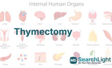 Thymectomy
