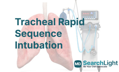 Tracheal Rapid Sequence Intubation
