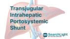Transjugular Intrahepatic Portosystemic Shunt