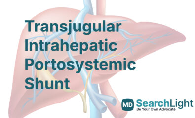 Transjugular Intrahepatic Portosystemic Shunt