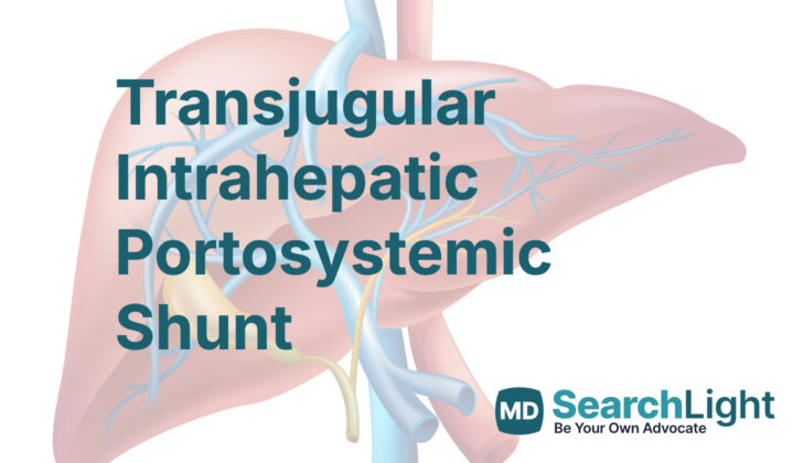 Transjugular Intrahepatic Portosystemic Shunt