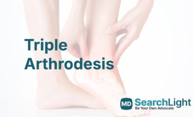 Triple Arthrodesis