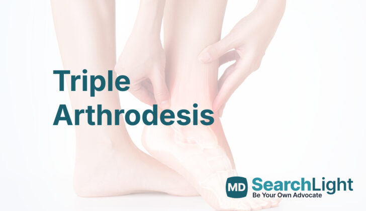 Triple Arthrodesis