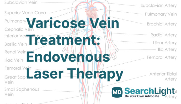 Varicose Vein Treatment: Endovenous Laser Therapy